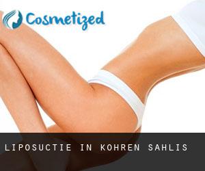 Liposuctie in Kohren-Sahlis
