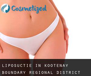 Liposuctie in Kootenay-Boundary Regional District