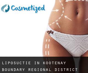 Liposuctie in Kootenay-Boundary Regional District