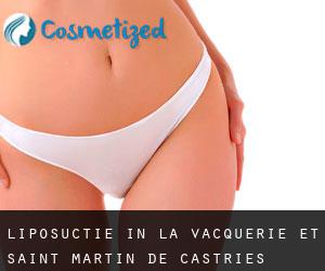 Liposuctie in La Vacquerie-et-Saint-Martin-de-Castries