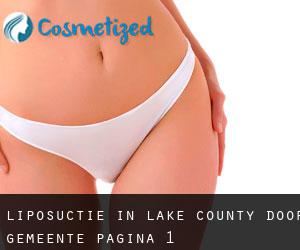Liposuctie in Lake County door gemeente - pagina 1