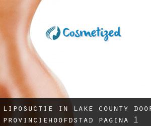 Liposuctie in Lake County door provinciehoofdstad - pagina 1