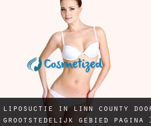 Liposuctie in Linn County door grootstedelijk gebied - pagina 1