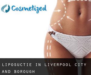 Liposuctie in Liverpool (City and Borough)