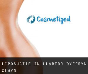 Liposuctie in Llabedr-Dyffryn-Clwyd
