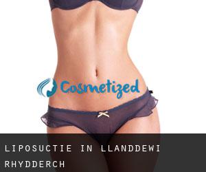 Liposuctie in Llanddewi Rhydderch