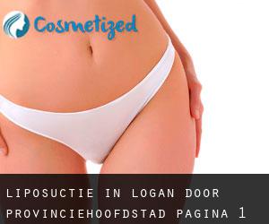 Liposuctie in Logan door provinciehoofdstad - pagina 1