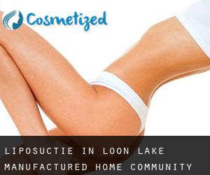Liposuctie in Loon Lake Manufactured Home Community