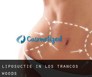 Liposuctie in Los Trancos Woods