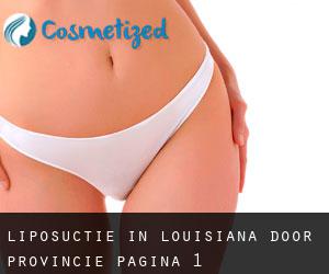 Liposuctie in Louisiana door Provincie - pagina 1