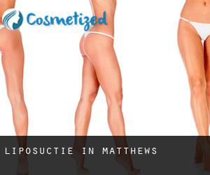 Liposuctie in Matthews
