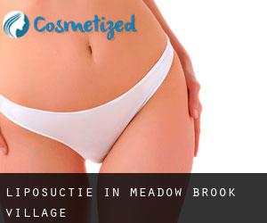 Liposuctie in Meadow Brook Village
