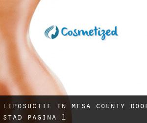Liposuctie in Mesa County door stad - pagina 1