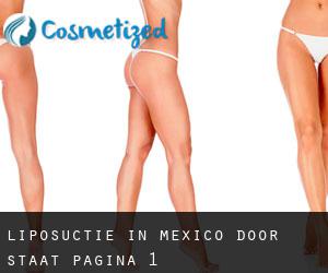 Liposuctie in Mexico door Staat - pagina 1