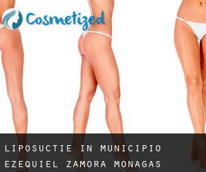 Liposuctie in Municipio Ezequiel Zamora (Monagas)