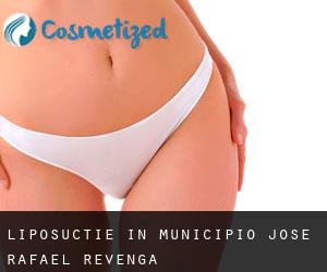 Liposuctie in Municipio José Rafael Revenga