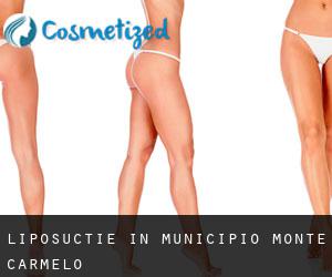 Liposuctie in Municipio Monte Carmelo