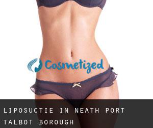 Liposuctie in Neath Port Talbot (Borough)