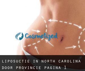 Liposuctie in North Carolina door Provincie - pagina 1