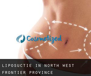 Liposuctie in North-West Frontier Province