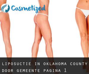 Liposuctie in Oklahoma County door gemeente - pagina 1