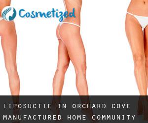 Liposuctie in Orchard Cove Manufactured Home Community