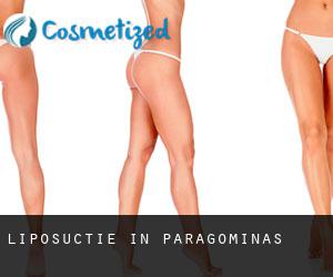 Liposuctie in Paragominas