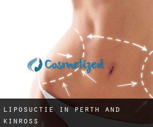 Liposuctie in Perth and Kinross