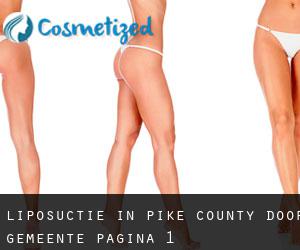 Liposuctie in Pike County door gemeente - pagina 1
