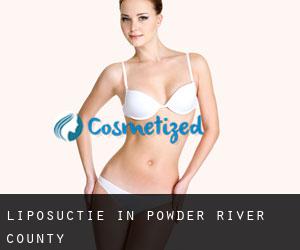 Liposuctie in Powder River County