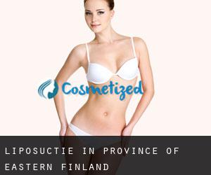 Liposuctie in Province of Eastern Finland