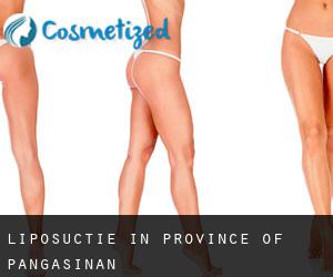 Liposuctie in Province of Pangasinan
