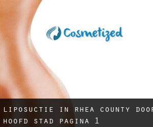 Liposuctie in Rhea County door hoofd stad - pagina 1