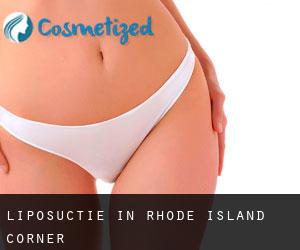 Liposuctie in Rhode Island Corner