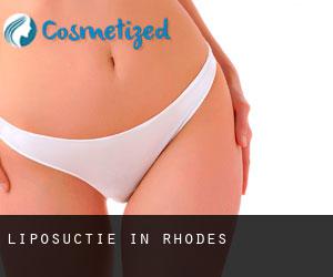 Liposuctie in Rhodes