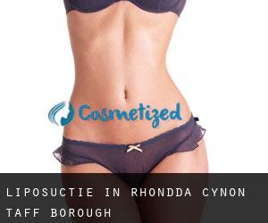 Liposuctie in Rhondda Cynon Taff (Borough)
