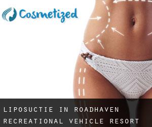 Liposuctie in Roadhaven Recreational Vehicle Resort