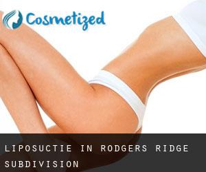 Liposuctie in Rodgers Ridge Subdivision