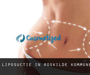 Liposuctie in Roskilde Kommune