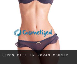Liposuctie in Rowan County
