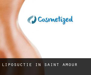 Liposuctie in Saint-Amour