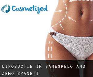 Liposuctie in Samegrelo and Zemo Svaneti