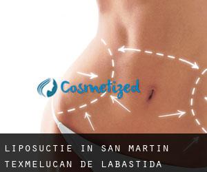 Liposuctie in San Martín Texmelucan de Labastida
