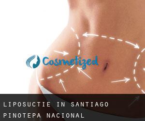 Liposuctie in Santiago Pinotepa Nacional