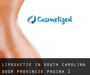 Liposuctie in South Carolina door Provincie - pagina 1
