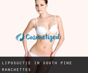 Liposuctie in South Pine Ranchettes