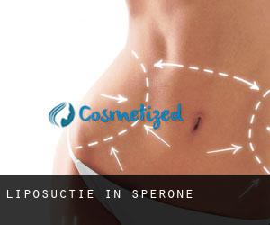 Liposuctie in Sperone