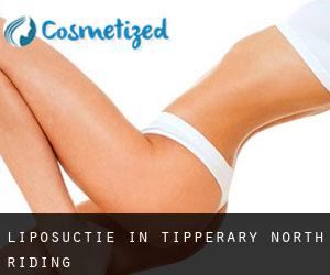 Liposuctie in Tipperary North Riding