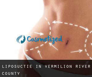 Liposuctie in Vermilion River County