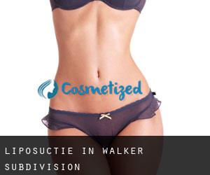 Liposuctie in Walker Subdivision